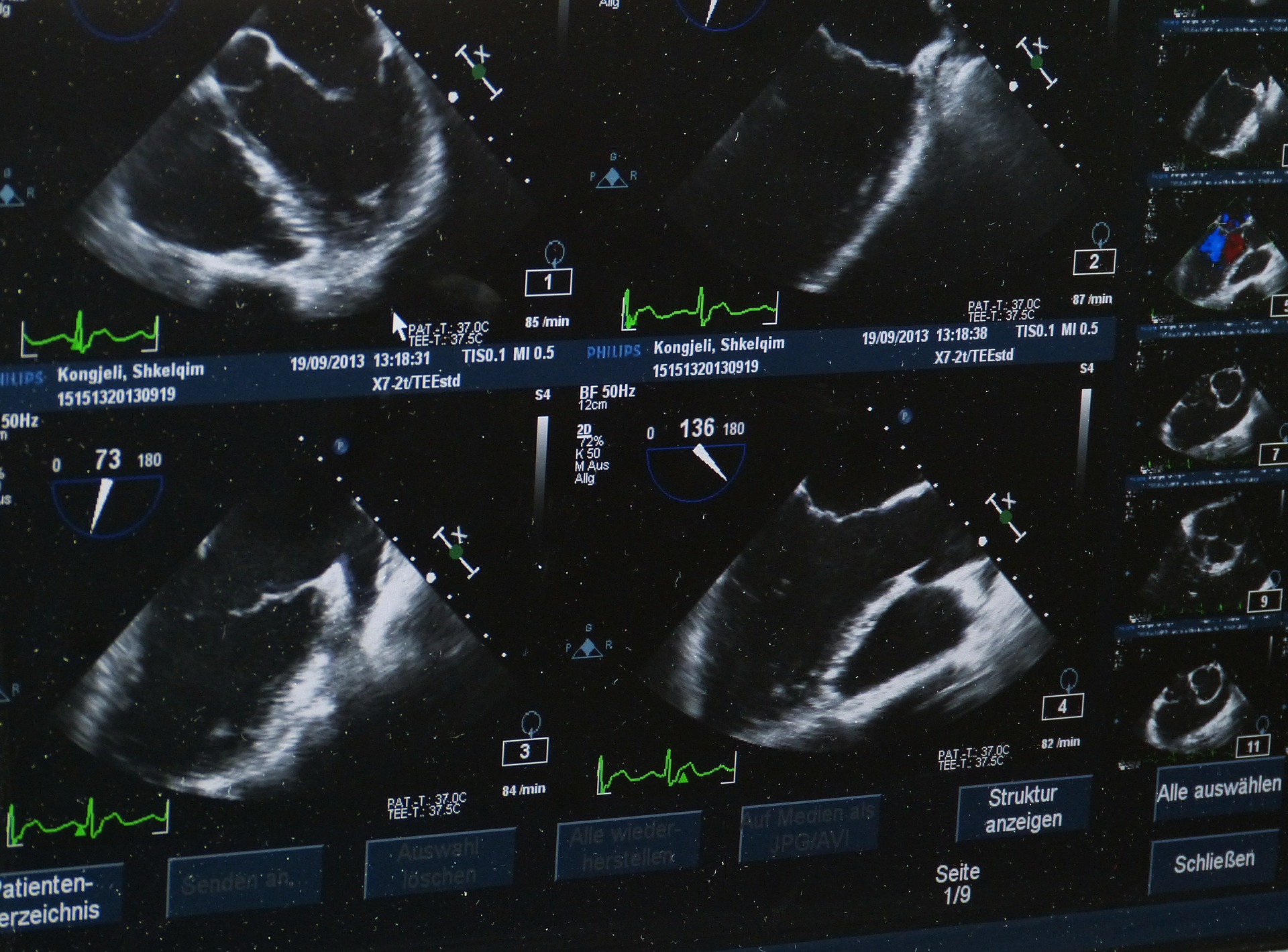 ultrasound-509396_1920