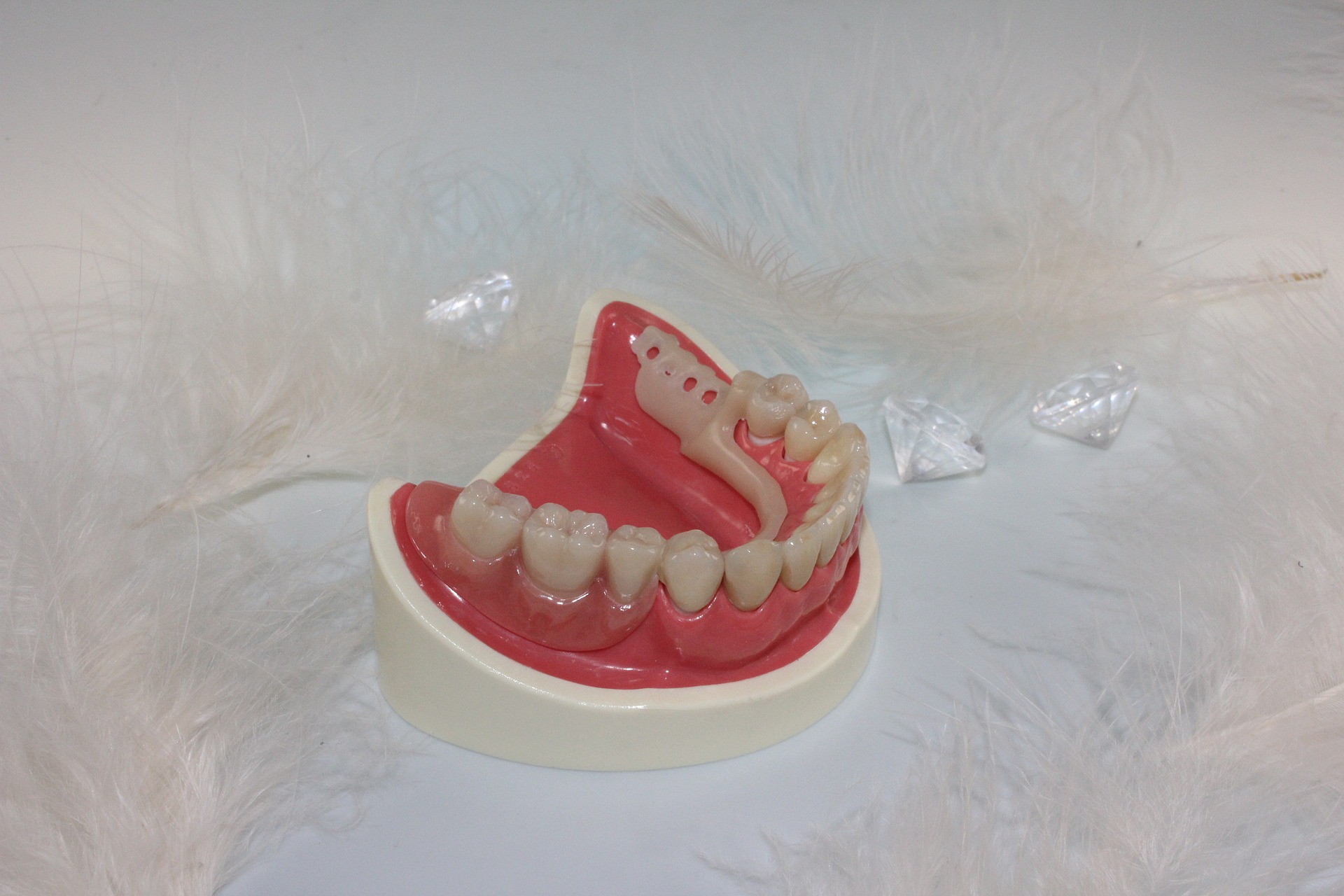 dentures-759925_1920